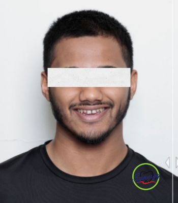 Before: Digital Smile Design