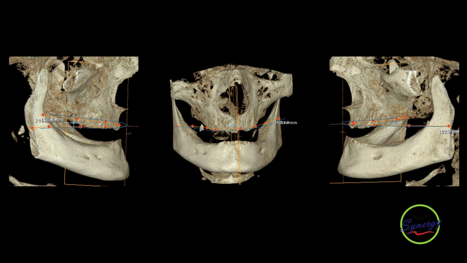 Clinical View 2
